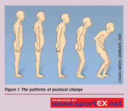 Correct posture with Spinal Touch Therapy, Chilliwack